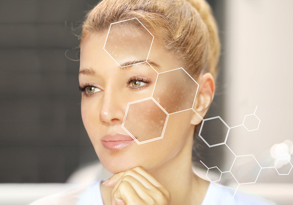 Elimina alunitele, punctele negre si petele de pe piele cu un preparat foarte simplu si eficient. Ai si tu pete maronii pe fata sau petele de batranete ?